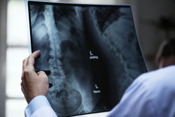 seguro radiologia